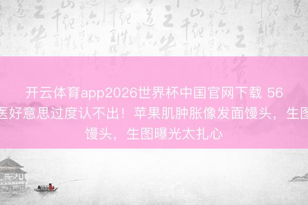 开云体育app2026世界杯中国官网下载 56岁徐姓女星医好意思过度认不出！苹果肌肿胀像发面馒头，生图曝光太扎心